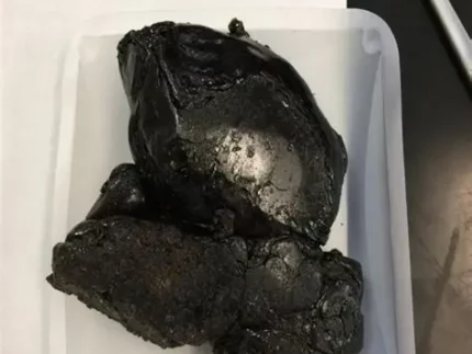 Buy heroin Isle of Man online, Isle of Man heroin for sale, heroin trafficking Isle of Man, darknet heroin Isle of Man, online heroin purchase Isle of Man, synthetic opioids Isle of Man, fentanyl Isle of Man, heroin overdose Isle of Man, heroin addiction Isle of Man, darknet drug market Isle of Man, cryptocurrency heroin Isle of Man, heroin smuggling Isle of Man, illegal heroin sales Isle of Man, narcotics trading Isle of Man, heroin courier Isle of Man, opioid crisis Isle of Man, Isle of Man drug enforcement, street heroin Isle of Man, online opioid sale Isle of Man, opioid overdose prevention Isle of Man.